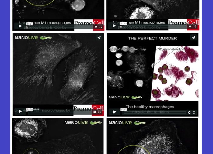 Nanolive – Macrophages – The Big Eaters