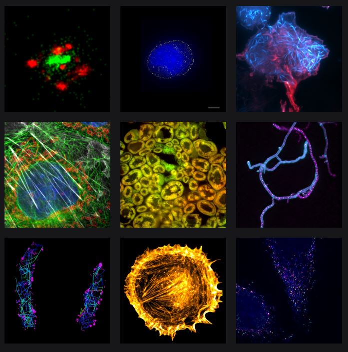 Super-Resolution Applications with the Nanoimager.