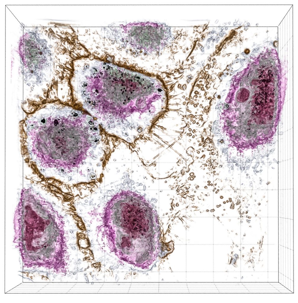 Liver nanotoxicity study; monitoring of the uptake of nanodiamond particles (dark spots inside the cells) into liver cells.