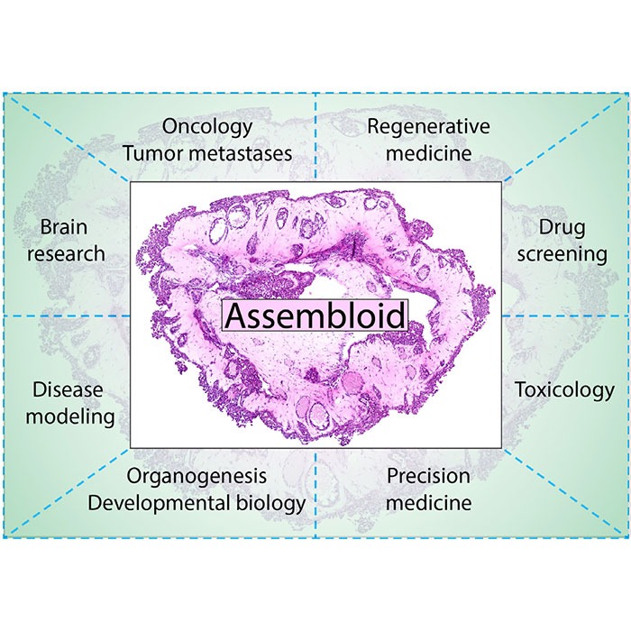 A 3D Bioprinted Model of Multicellular Lung Cancer Assembloids