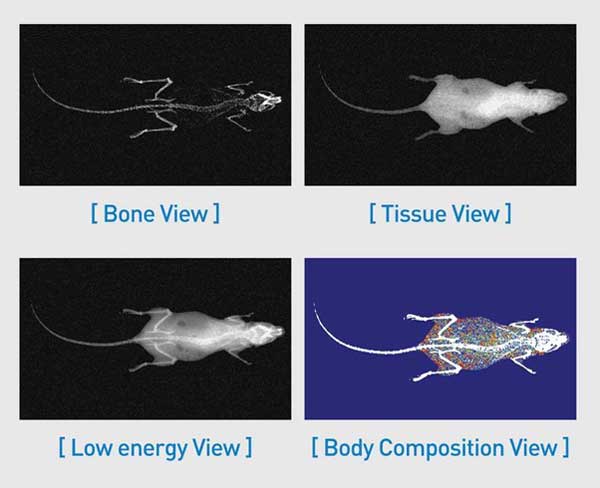 DEXA images - dual energy x-ray absorptiometry