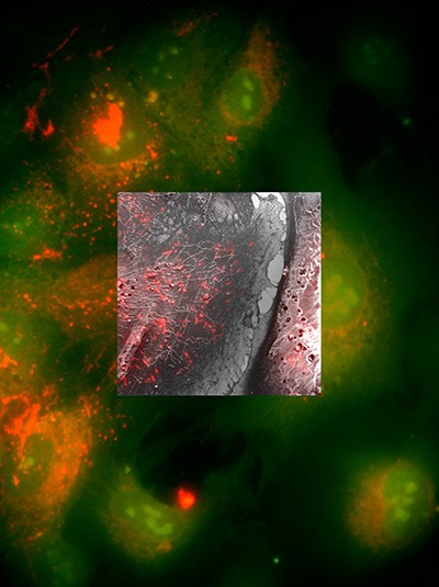 Human umbilical vein endothelial cells (HUVECs) cultured on ITO coated coverslips. Weibel-Palade bodies containing von Willebrand factor (VWF, small rod-like structures) are clearly visible in both the FM and EM images. Immunolabelled using Phalloidin Alexa 488 (Invitrogen, molecular probes) in green and goat anti-rabbit Alexa 568 (Invitrogen, molecular probes), Rabbit anti Human VWF antibody (Dako) in red. Samples courtesy of M.J. Mourik (LUMC, Leiden, The Netherlands).