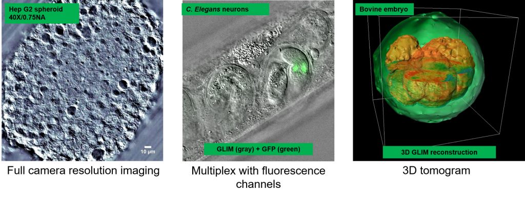 Phi Optics GLIM Gradient Light Interference Microscopy