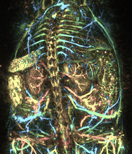 Next Generation Photoacoustic Imaging for Translational Research