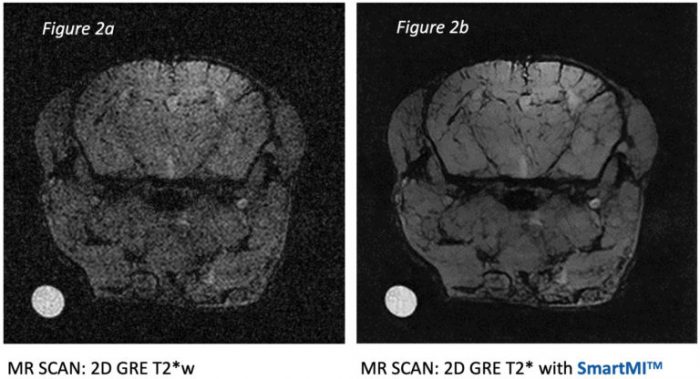 SmartMI AI enhanced MRI image from MR Solutions