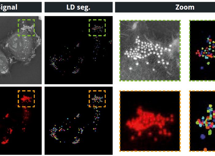 Nanolive’s Smart Lipid Drop Assay Opens a New Window to Lipid Droplet Dynamics