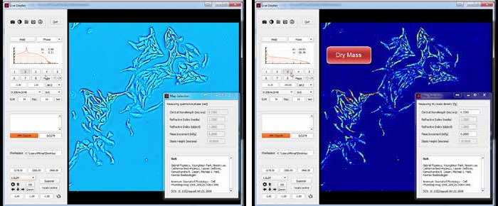 Spatial Light Interference Microscopy (SLIM) – Principes and Capabilities