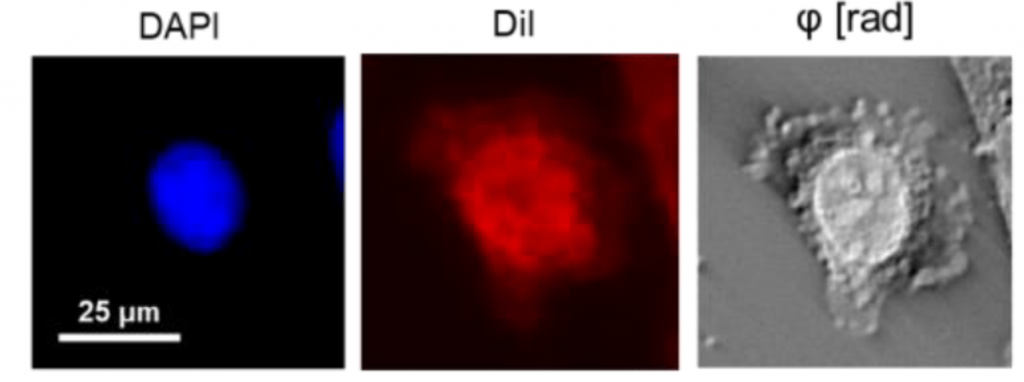 Phi Optics Phase Imaging with Computational Specificity (PICS) human epithelial cells