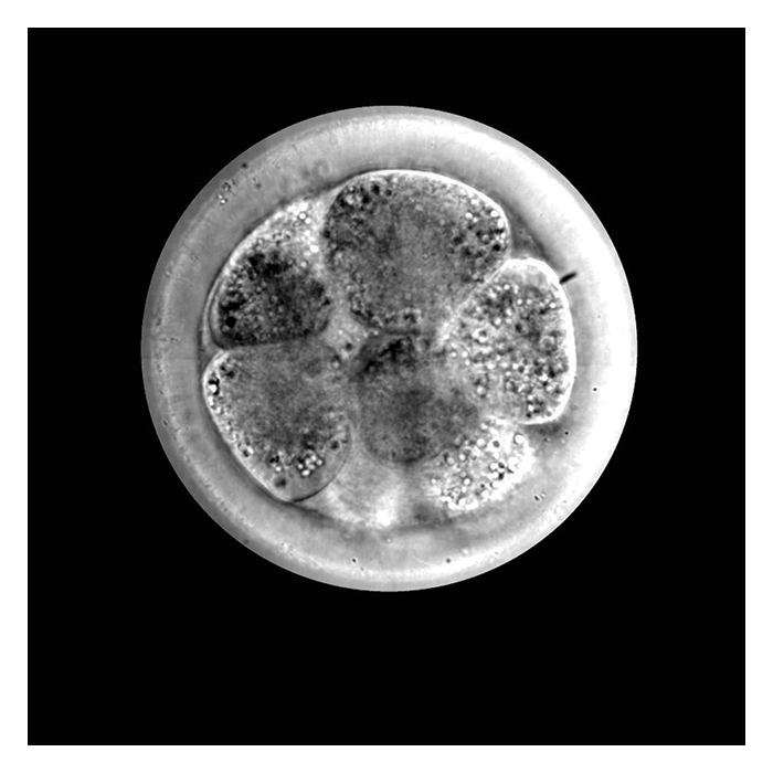 Imaging Organoids and Optically Thick Samples with GLIM