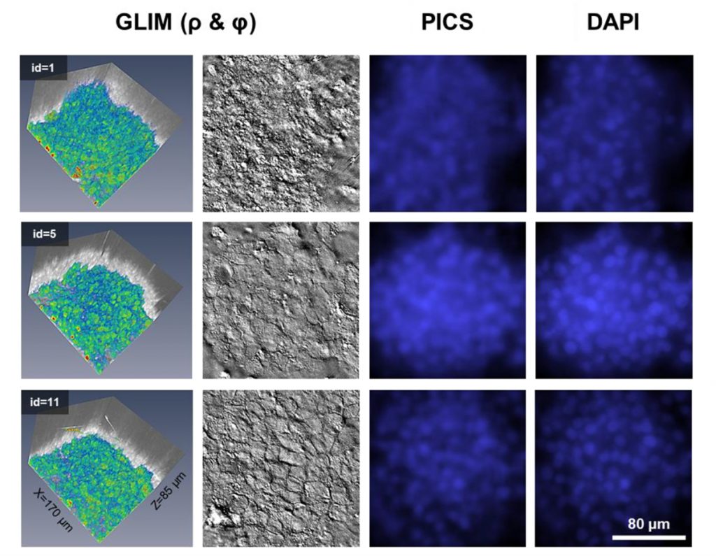 Phi Optics Phase Imaging with Computational Specificity (PICS)liver cells
