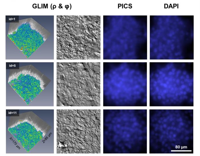 Phi Optics Phase Imaging with Computational Specificity (PICS)