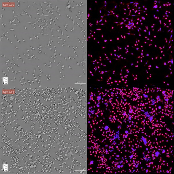 Phi Optics Phase Imaging with Computational Specificity (PICS) time lapse study
