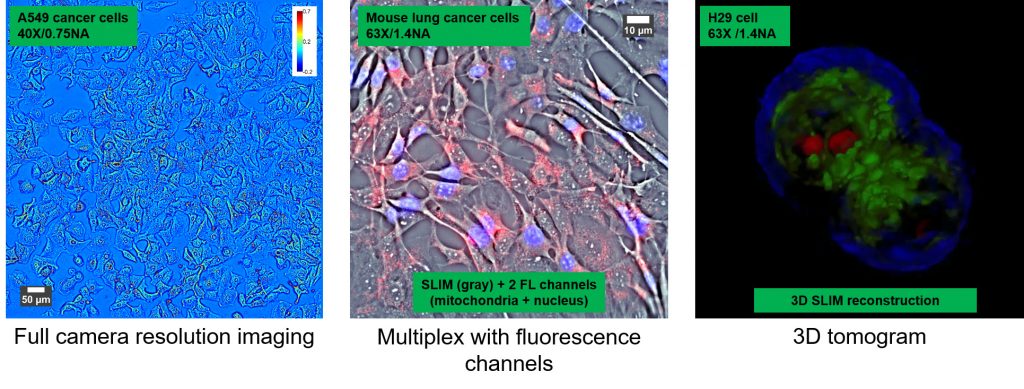 Advantages of Phi Optics SLIM imaging of live cells