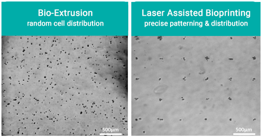 Laser assisted bioprinting - demonstrating precise positioning and patterning