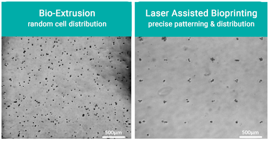 Laser assisted bioprinting - demonstrating precise positioning and patterning