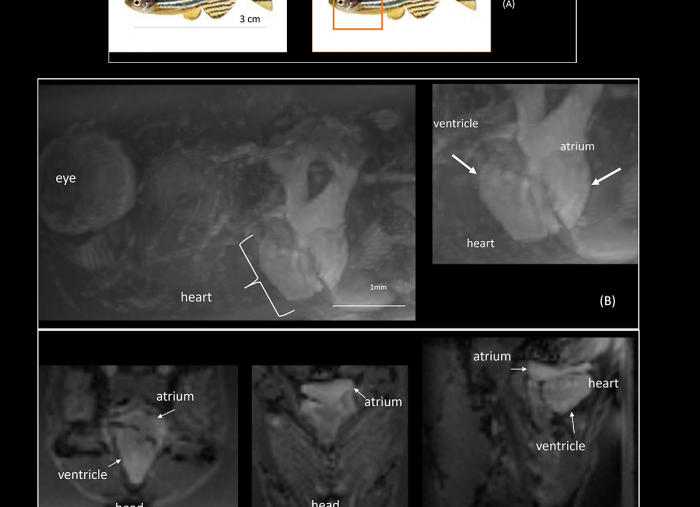 Dilated Cardiomyopathy Research at Victor Chang Cardiac Research Institute