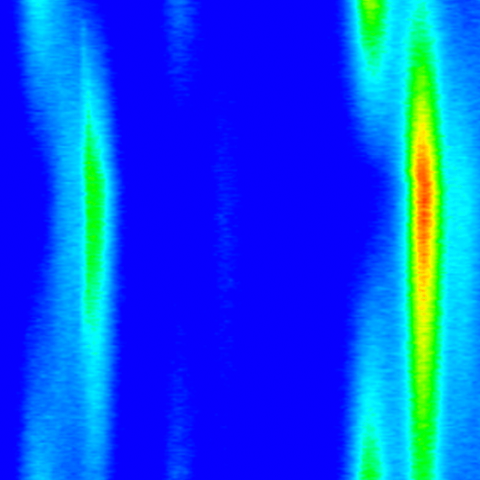 Operando Measurement of Laminated Lithium Ion Battery Using 2D Detector