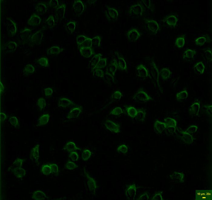 Fluorescent imaging of SARS-Cov-2 using the Etaluma Lumascope LS620