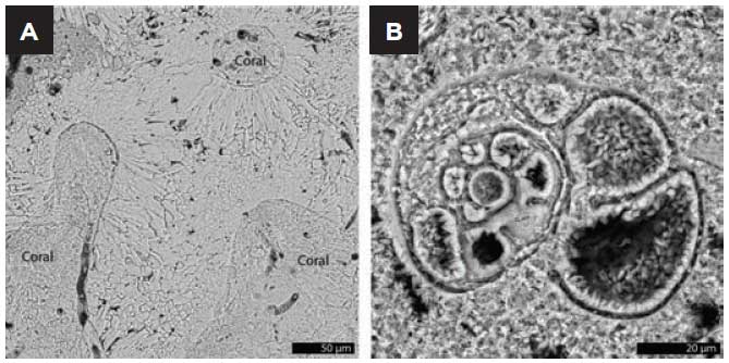 fossilised coral structures imaged using the TESCAN TIMA autoated  ineralogy system.