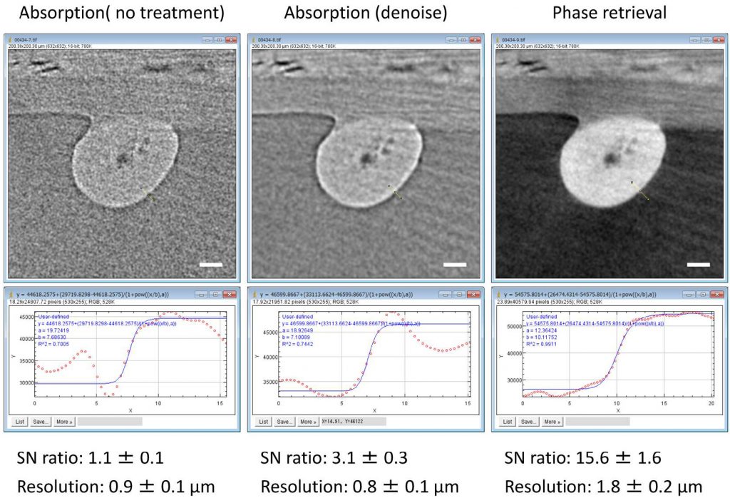 Computed tomography microCT of a human hair and the benefits of phase retriveval.