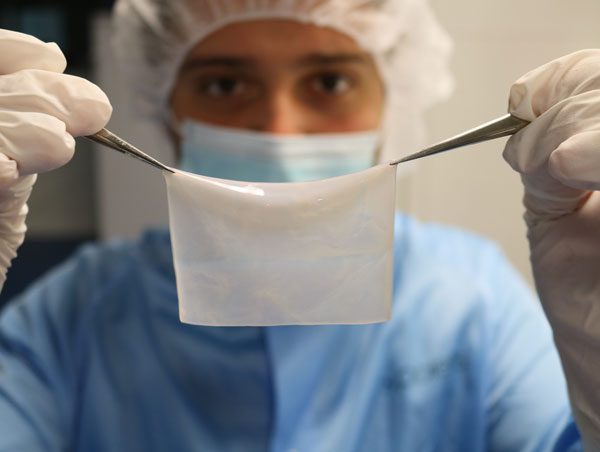 Poietis poieskin Bioprinted Skin Substitute