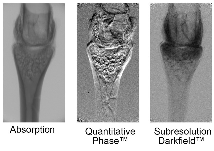 Shown above is a tri-contrast image of a frog’s toe joint using the Sigray PrismaXRM; different features are clearly visible in each mode of contrast, such as the spongey tissue using the darkfield and musculature in phase contrast.