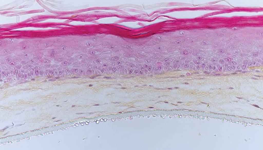 Poieskin® Bioprinted Human Full Thickness Skin Model